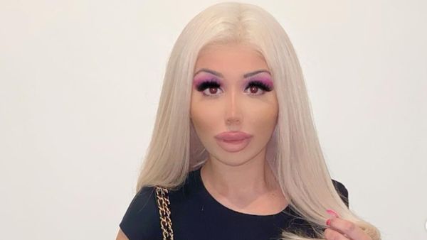 8 Potret Wanita yang Terobsesi Jadi Boneka Bratz, Sebelum Oplas Beda Banget!