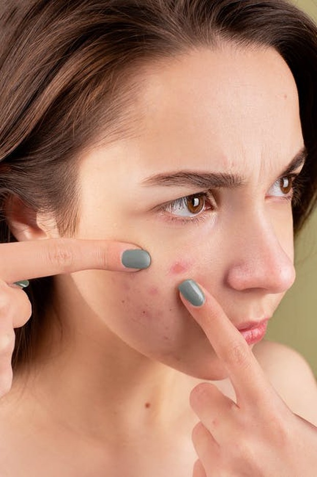 Terhindar dari Munculnya Jerawat / foto : pexels.com/AnnaNekrashevich
