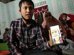 Wanita di Sumut Meninggal Dunia Usai Tak Sengaja Telan Gigi Palsu