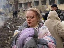 Viral Potret Wanita Hamil Korban Bom Rusia, Ternyata Beauty Blogger Ukraina