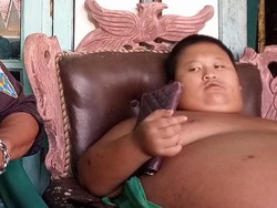 Bocah Berbobot 126 Kg di Bekasi Habiskan Rp 50 Ribu Per Hari untuk Jajan