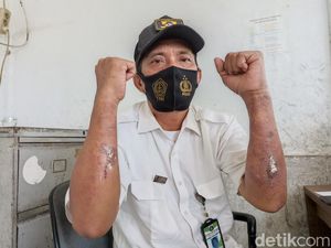 Polusi Batu Bara di Marunda, 13 Warga Keluhkan ISPA-9 Radang Kulit Polusi Batu Bara di Marunda, 13 Warga Keluhkan ISPA-9 Radang Kulit