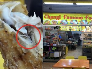 Lagi Asyik Makan Nasi Lemak, Netizen Ini Temukan Belatung dalam Daging Ayam! Lagi Asyik Makan Nasi Lemak, Netizen Ini Temukan Belatung dalam Daging Ayam!