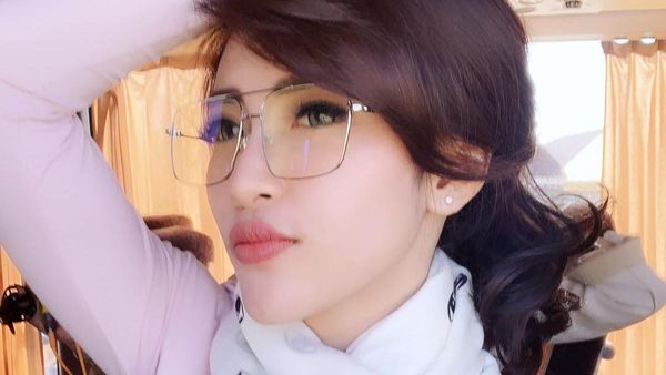 Ini Luka Lebam di Tubuh Citra Andy Usai Dilecehkan-Dianiaya Teman Suami Olla Ramlan
