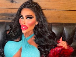 Ngeri, Wanita Gila Oplas Ini Habiskan Rp 2 M, Sudah 5 Kali Operasi Payudara