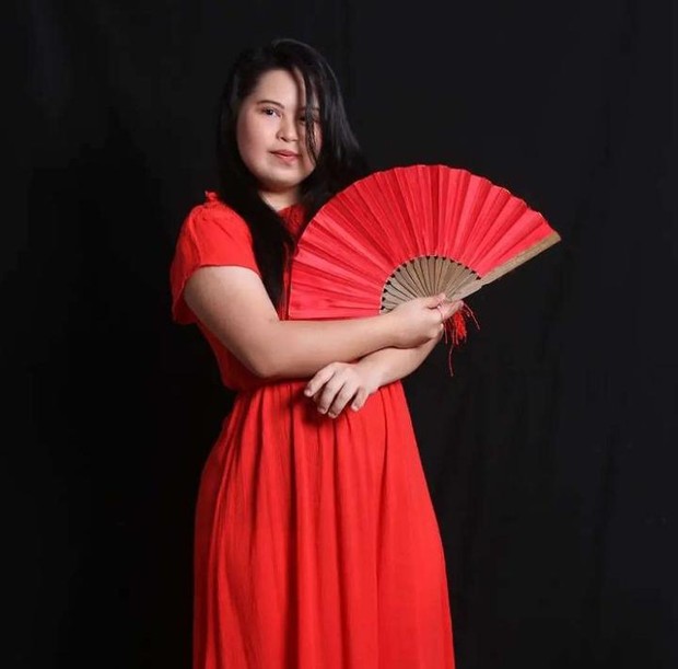 Namira Zania Siregar/foto: instagram.com/namirazaniaa Namira adalah model sekaligus penari dengan down syndrome asal Indonesia