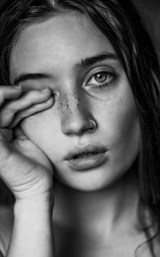 Terlalu Sering Menggosok Mata