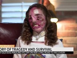 Tragedi Wanita yang Digigit Anjing 800 Kali, Wajahnya Jadi Tak Berbentuk Lagi