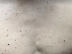 Alex Rins Dapat Souvenir dari Sirkuit Mandalika: Dada Kena Serpihan Aspal