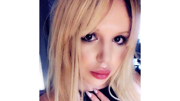 8 Transformasi Pria Habis Rp 1 M Oplas Mirip Britney Spears, Begini Jadinya