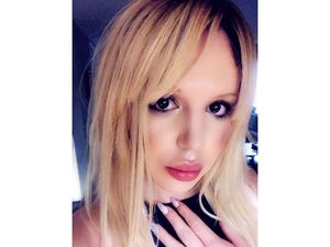 8 Transformasi Pria Habis Rp 1 M Oplas Mirip Britney Spears, Begini Jadinya