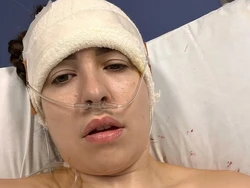 Baru Kelar Operasi Otak, Model OnlyFans Nekat Bikin Konten di Kasur RS