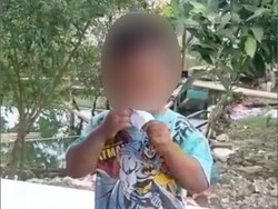 Ini Saran Dokter ke Ortu soal Bocah Bekasi Doyan Makan Sandal-Kertas