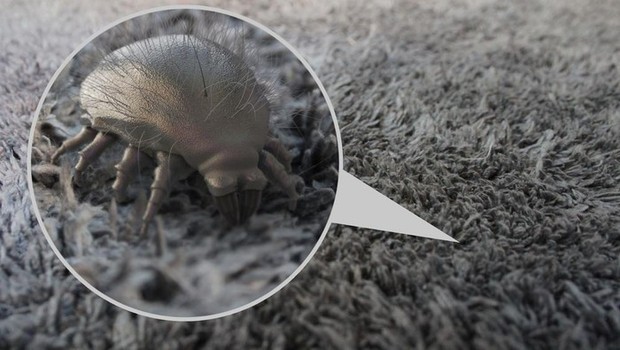 Tungau Atau Kutu Busuk Jumlahnya Bisa Sampai 1,5juta Ada Di Tempat Tidur/Foto : wolipop.detik.com/Lifestyle Wolipop