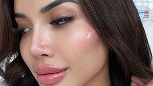 7 Foto Wajah Baru Millen Cyrus yang Suntik Filler Supaya Mirip Angelia Jolie