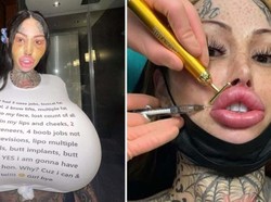 Terobsesi Kurus, Model Ini Rela Hanya Makan Cheetos Sampai Tak Bisa Jalan