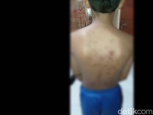 Dua Siswa SMP di Pasuruan Disebut Sempat Diculik Sebelum Dihajar Senior Dua Siswa SMP di Pasuruan Disebut Sempat Diculik Sebelum Dihajar Senior