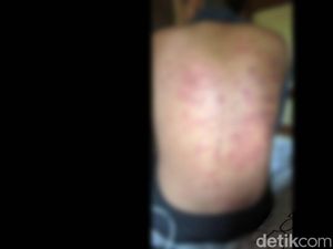 Kejinya Senior Sundut Rokok-Cambuk 2 Siswa SMP di Pasuruan Kejinya Senior Sundut Rokok-Cambuk 2 Siswa SMP di Pasuruan