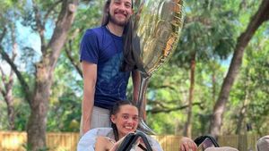 8 Potret Model yang Kedua Kakinya Terpaksa Diamputasi karena COVID-19