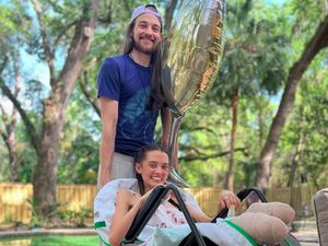 8 Potret Model yang Kedua Kakinya Terpaksa Diamputasi karena COVID-19