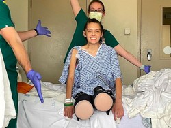 Komplikasi COVID-19, Kedua Kaki Model Ini Terpaksa Diamputasi