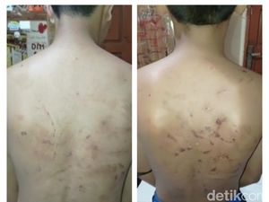 Dianiaya Senior dengan Keji, Siswa SMP di Pasuruan akan Pindah Sekolah Dianiaya Senior dengan Keji, Siswa SMP di Pasuruan akan Pindah Sekolah