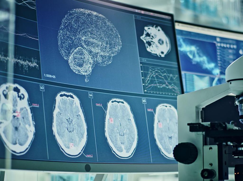 Studi AS Ungkap Covid-19 Memperparah Kerusakan Otak Jangka Panjang