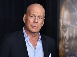 Afasia, Ketika Tiba-tiba Kemampuan Berbicara dan Kognitif Lenyap