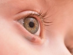 Ketahui Penyebab Kelopak Mata Bengkak, Gejala, dan Cara Mengobatinya