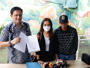 5 Fakta Mayang Alami Kerusakan Wajah hingga Somasi Skincare T 5 Fakta Mayang Alami Kerusakan Wajah hingga Somasi Skincare T