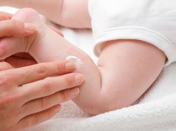 Eksim Kulit: Penyebab, Gejala, Hingga Cara Mengobatinya