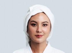 Catat! 5 Kandungan Serum Wajah yang Bantu Atasi Hiperpigmentasi