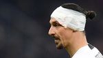 Zlatan Ibrahimovic Berdarah-darah di Laga Milan Vs Bologna