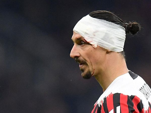 Zlatan Ibrahimovic Berdarah-darah di Laga Milan Vs Bologna