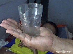 Tak Melulu Mistis, Begini Dokter Menjelaskan Gelas di Perut Pria Jember