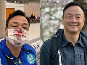 Aktor Hong Kong Berkali-kali Tes PCR hingga Mimisan dan Positif COVID-19