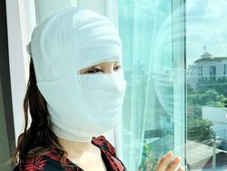 Lucinta Luna Ungkap Wajah Baru Usai Operasi Ganti Kepala, Begini Hasilnya