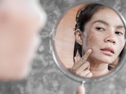 5 Rekomendasi Bahan Aktif untuk Memudarkan Bintik Hitam di Wajah