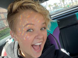 Jojo Siwa Curhat Alami Kebotakan Dini karena Stres Jadi Artis