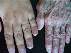 Ilmuwan Coba Rekayasa Sel Kulit Manusia Jadi 30 Tahun Lebih Muda