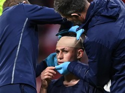 Pemain Man City Babak Belur, Dapat 71 Perawatan Fisioterapi