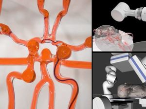 Keren! Robot Ini Bisa Operasi Stroke Jarak Jauh
