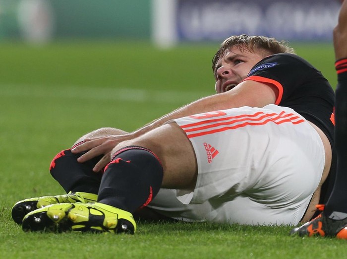 Luke Shaw mengalami cedera patah tulang kering saat membela Manchester United menghadapi PSV Eindhoven di Liga Champions 2015.