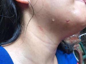 Tak Digorok, Anak Terkena Sabetan Pisau Ibu di Jaktim Hanya Luka Kecil