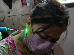 Biaya Hapus Tato Bervariasi, Ukuran dan Warna Turut Menentukan