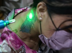 Catat! Ini Jadwal Layanan Hapus Tato Gratis di DKI Jakarta