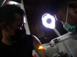 Tips Pilih Jasa Hapus Tato yang Aman, Asal-asalan Kulit Bisa Terbakar