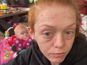 Baru Usia 22, Ibu Muda Ini Jadi Menua Setelah Melahirkan