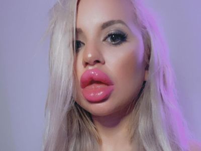 8 Foto Wanita Terobsesi Oplas Payudara Hingga Ukuran K, Kini Tak Diakui Ortu