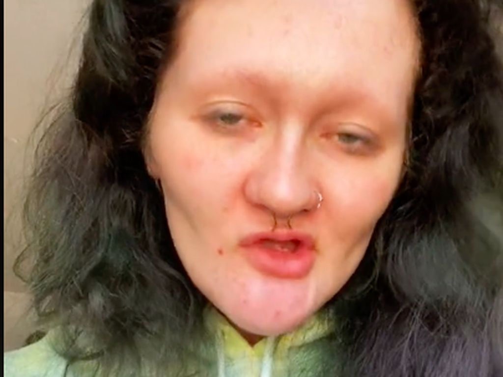 Tak Punya Gigi, Tranformasi Wanita Ini Viral Setelah Makeup